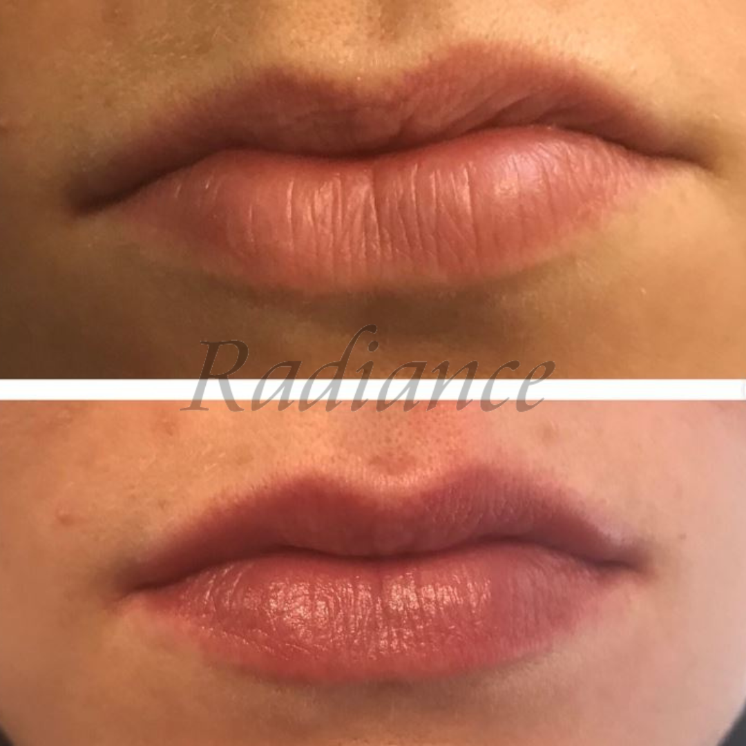 LIP TREATMENT SPF 30