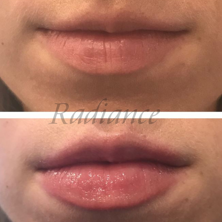 LIP TREATMENT SPF 30