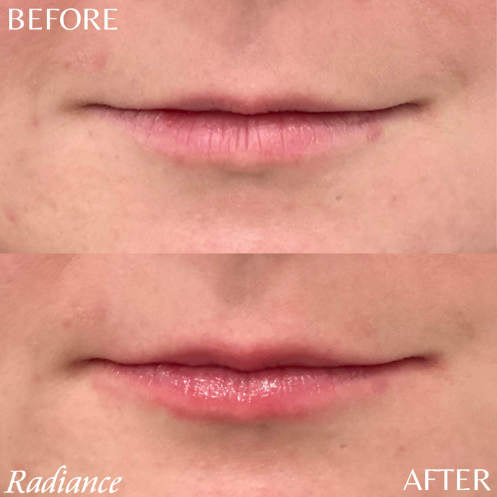 LIP TREATMENT SPF 30